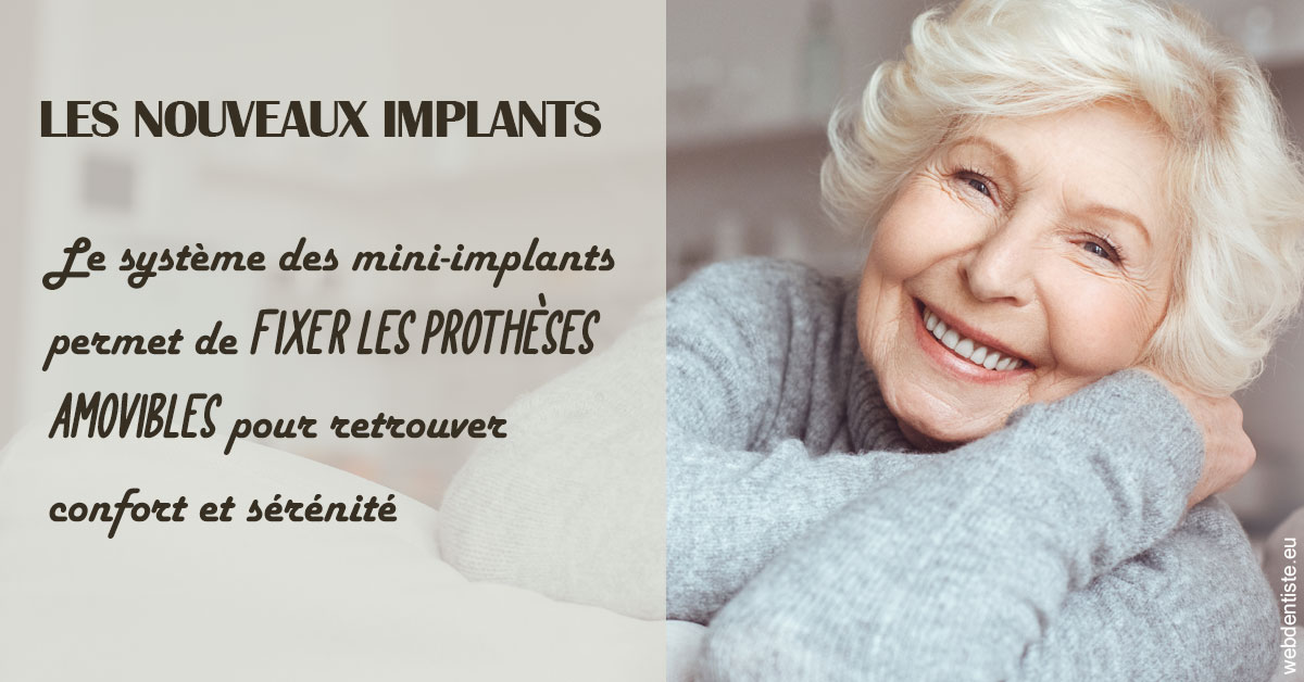 https://dr-barthelet-romain.chirurgiens-dentistes.fr/Les nouveaux implants 1