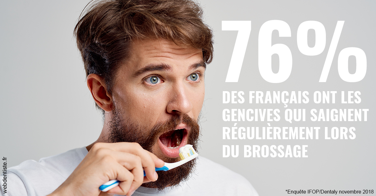 https://dr-barthelet-romain.chirurgiens-dentistes.fr/76% des Français 2