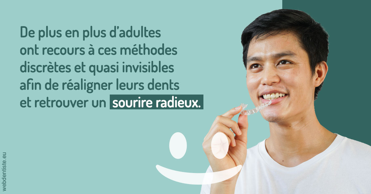 https://dr-barthelet-romain.chirurgiens-dentistes.fr/Gouttières sourire radieux 2