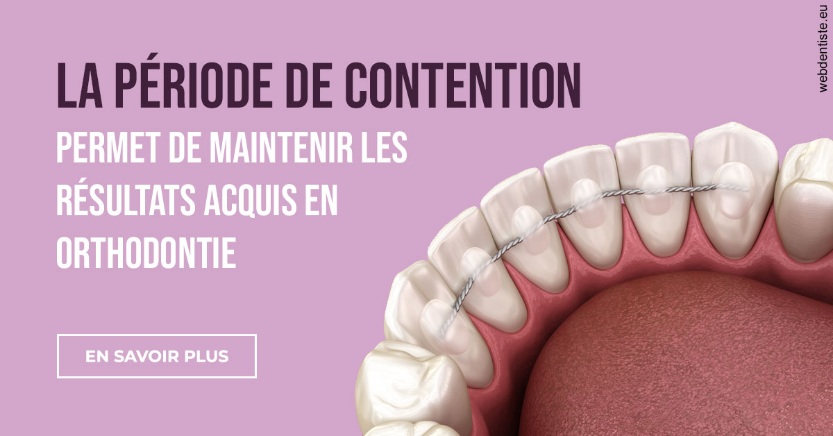 https://dr-barthelet-romain.chirurgiens-dentistes.fr/La période de contention 2