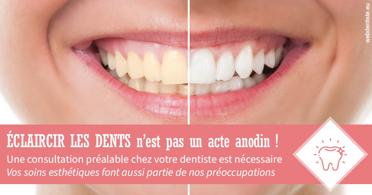 https://dr-barthelet-romain.chirurgiens-dentistes.fr/Eclaircir les dents 1