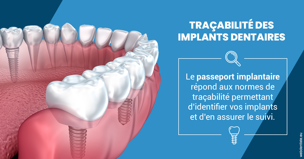 https://dr-barthelet-romain.chirurgiens-dentistes.fr/T2 2023 - Traçabilité des implants 1