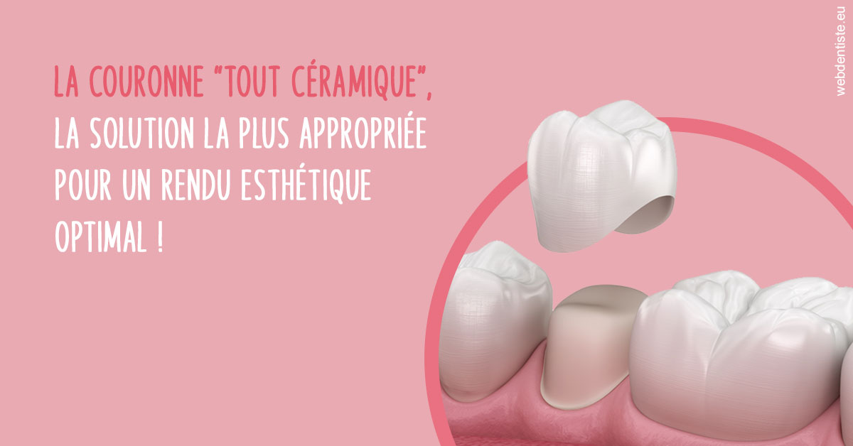 https://dr-barthelet-romain.chirurgiens-dentistes.fr/La couronne "tout céramique"