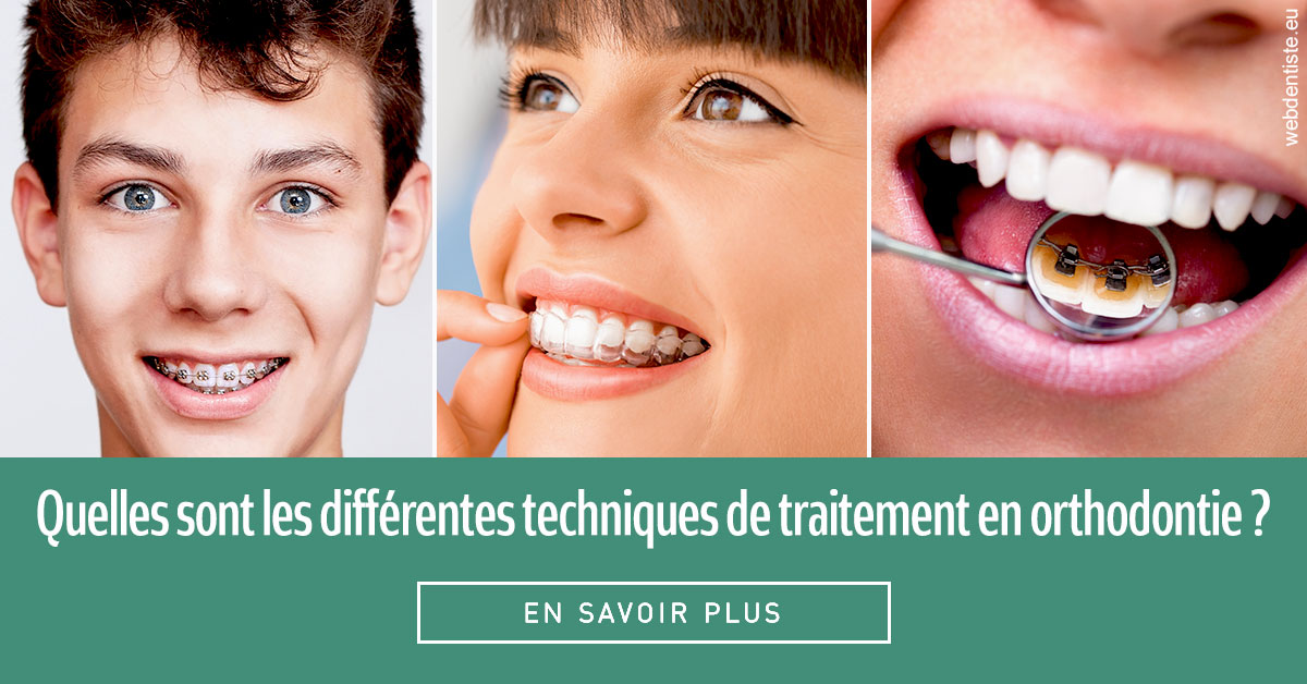 https://dr-barthelet-romain.chirurgiens-dentistes.fr/Les différentes techniques de traitement 2