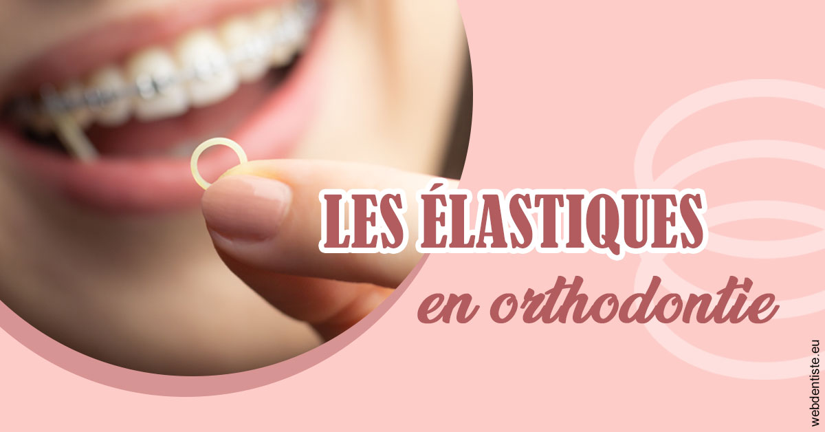 https://dr-barthelet-romain.chirurgiens-dentistes.fr/Elastiques orthodontie 1