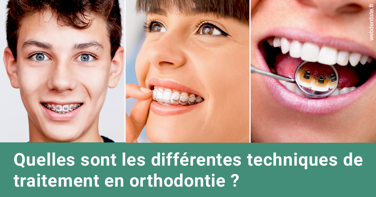 https://dr-barthelet-romain.chirurgiens-dentistes.fr/Les différentes techniques de traitement 2