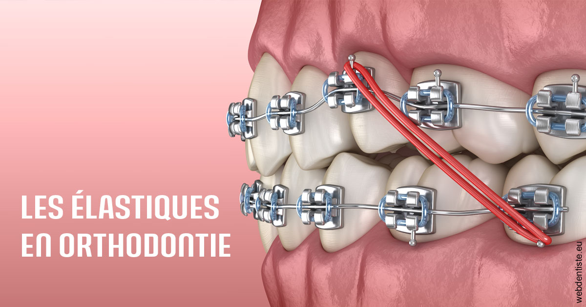 https://dr-barthelet-romain.chirurgiens-dentistes.fr/Elastiques orthodontie 2