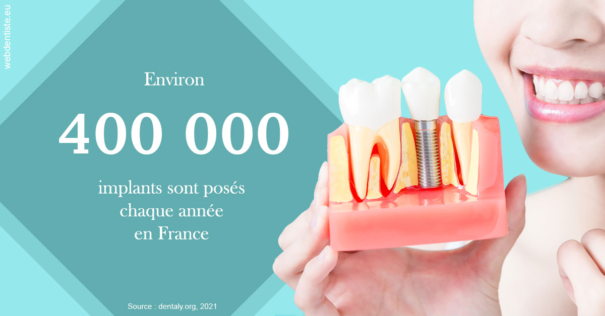 https://dr-barthelet-romain.chirurgiens-dentistes.fr/Pose d'implants en France 2