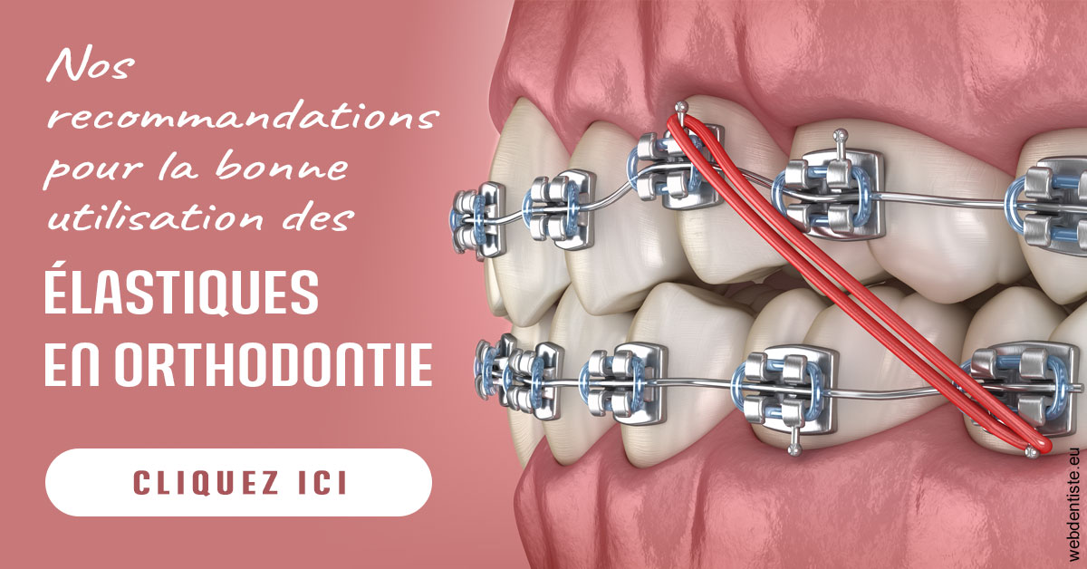 https://dr-barthelet-romain.chirurgiens-dentistes.fr/Elastiques orthodontie 2